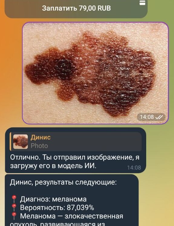 Skin Cancer Detection via Photo